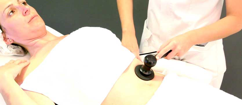 Cómo se aplica la radiofrecuencia para tratamientos de estética