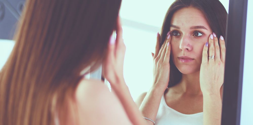 Soluciones naturales a las bolsas y ojeras