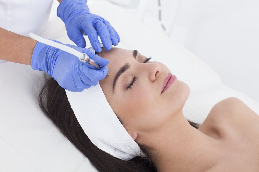 ¿Qué es la microdermoabrasión?